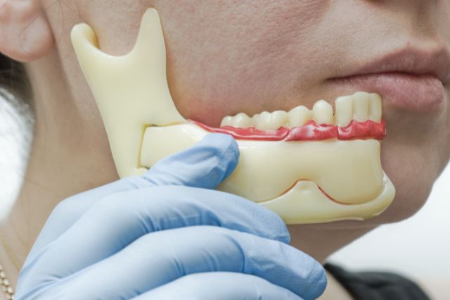 cmd symptome cmd symptome