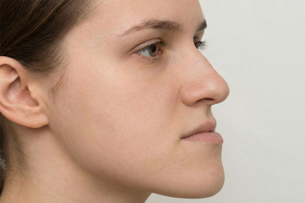 Wobei hilft Dentosophie 2 1